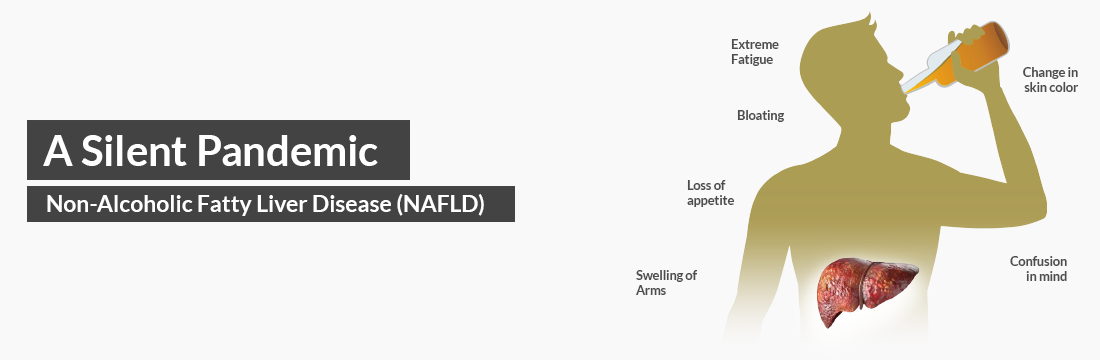  A Silent Pandemic: Non-Alcoholic Fatty Liver Disease (NAFLD)